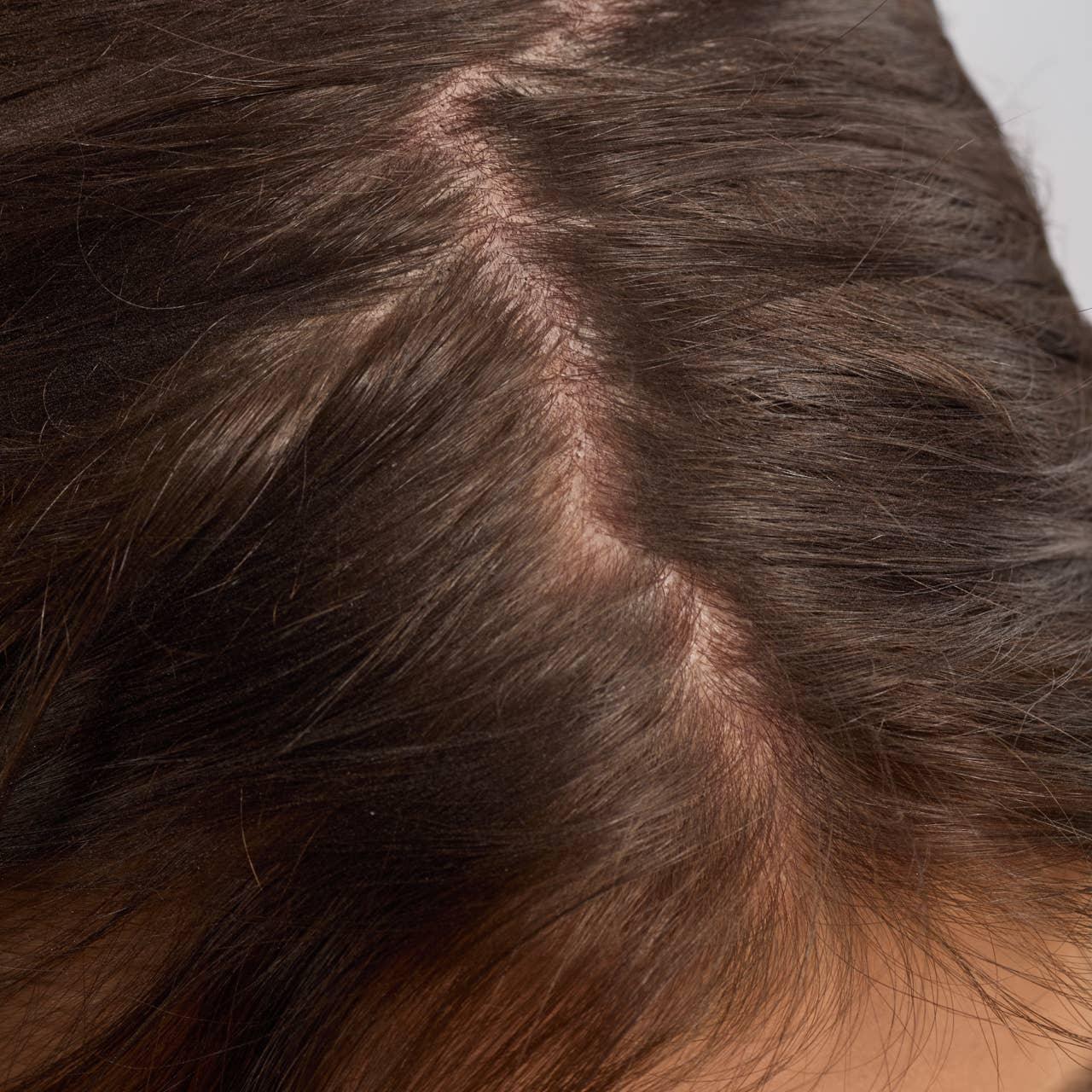 Close-up of a woman's brown hair and scalp, healthy roots visible. Come see us at Awaken, Franklin, Tennessee.